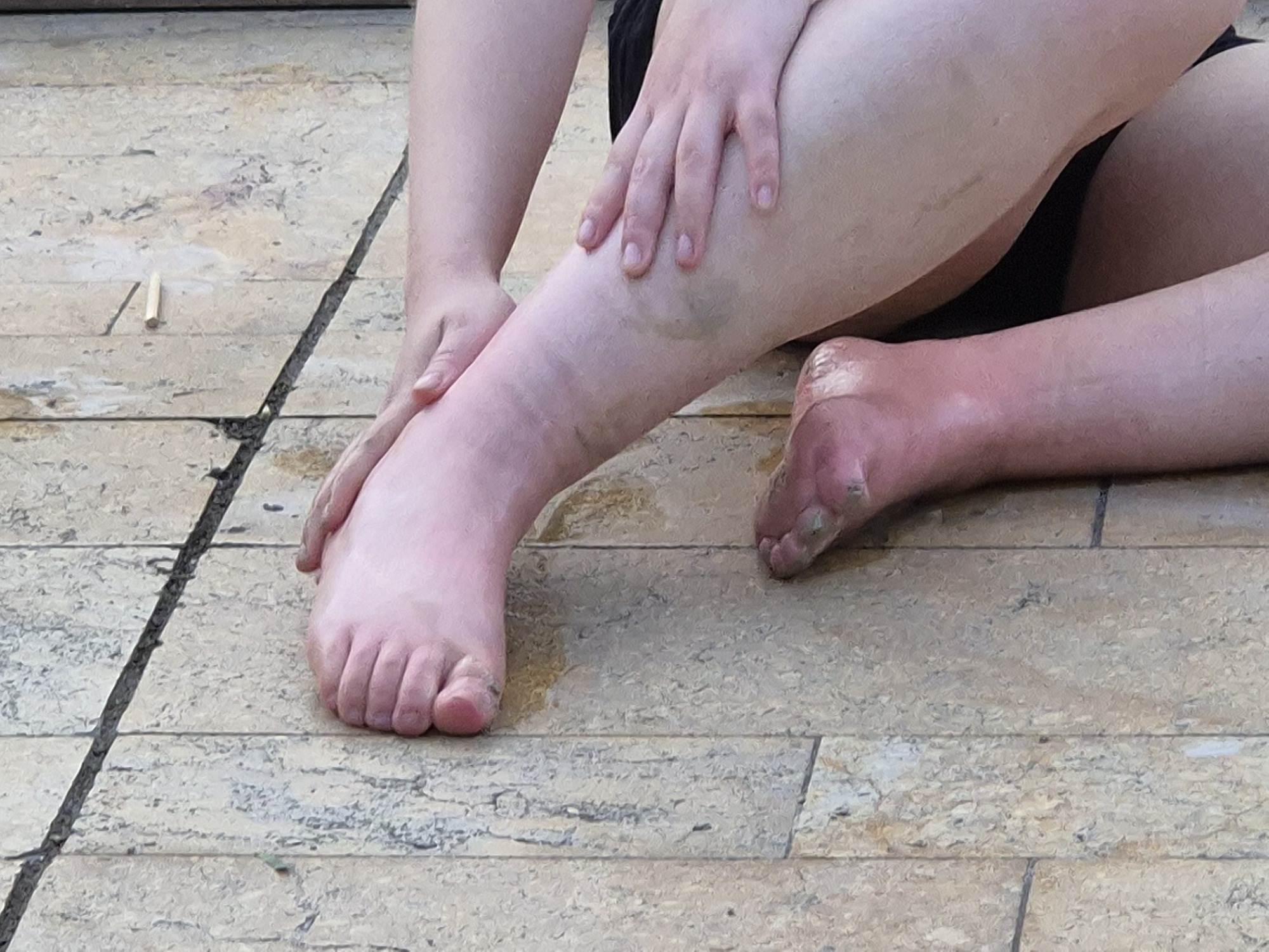 Performance Anestesiada - Imagen 9